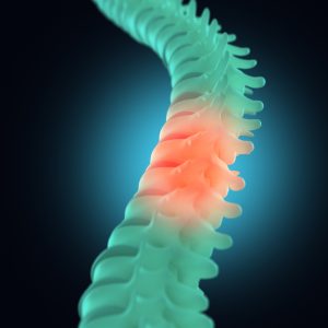Spinal injury or pain