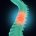 Spinal injury or pain