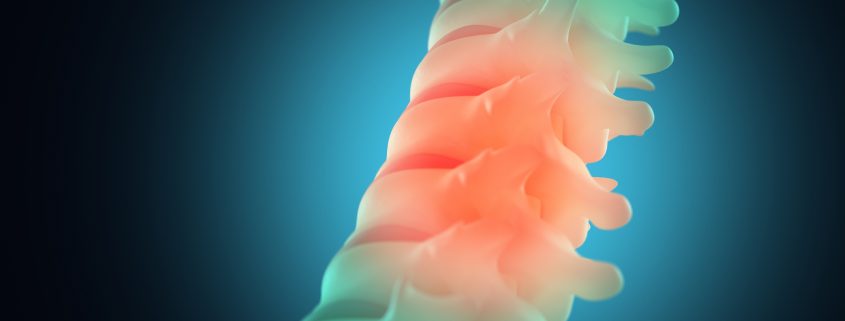 Spinal injury or pain